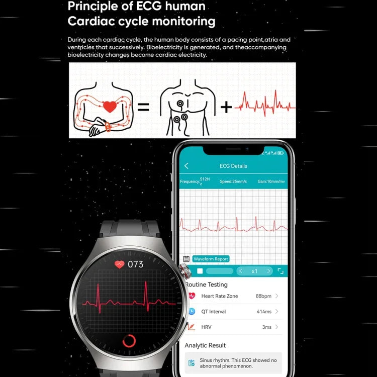 Đồng hồ gọi thông minh dây thép IP67 màn hình AMOLED 1.43 inch MT200, Hỗ trợ ECG