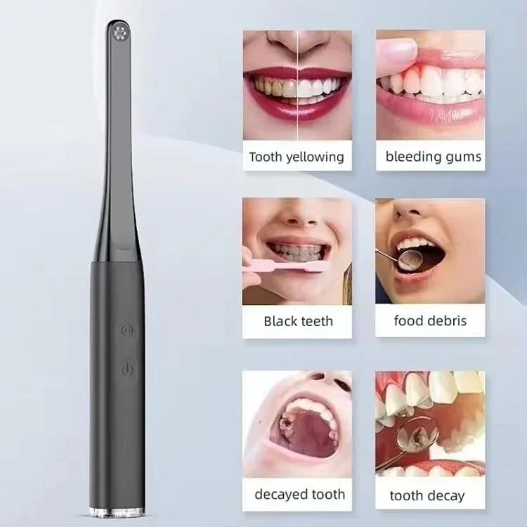 Máy quan sát miệng FY-B800 không dây WiFi, nội soi miệng HD