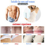 Dụng cụ triệt lông bằng laser IPL không đau cho gia đình, dùng chung cho nam và nữ