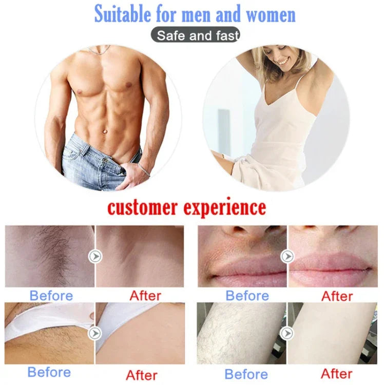 Dụng cụ triệt lông bằng laser IPL không đau cho gia đình, dùng chung cho nam và nữ