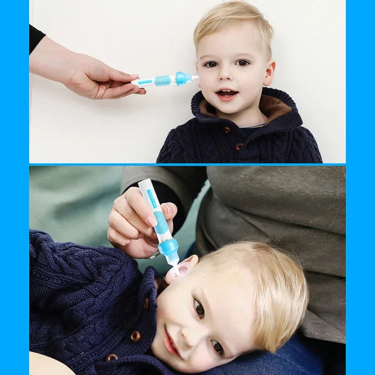 Dụng cụ làm sạch tai điện nhẹ nhàng và hiệu quả cho trẻ em, máy làm sạch tai