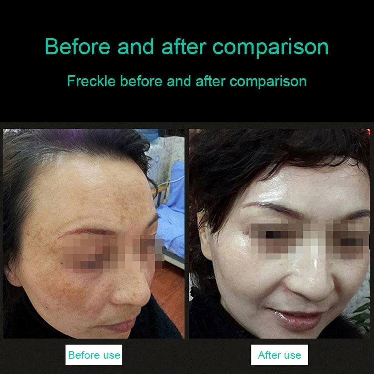 画像代替テキスト