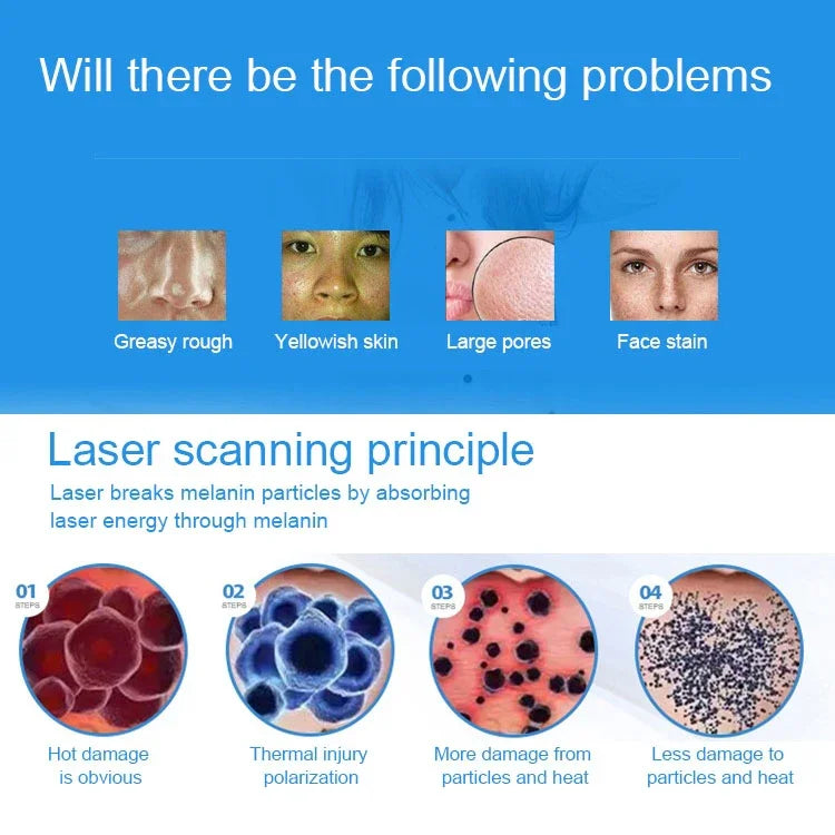 Máy cầm tay Picosecond di động (xóa xăm, tàn nhang, nốt ruồi) bút chăm sóc sắc đẹp laser plasma, USB / ánh sáng xanh, USB / ánh sáng đỏ