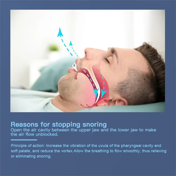 Thiết bị chống ngáy YJK100 làm từ silicone + ABS