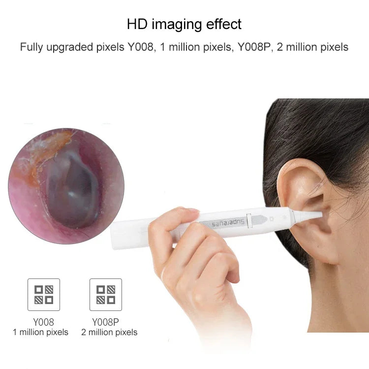 Nội soi điện tử không dây Supereyes Y008P cho tai, mũi, miệng, Y008P