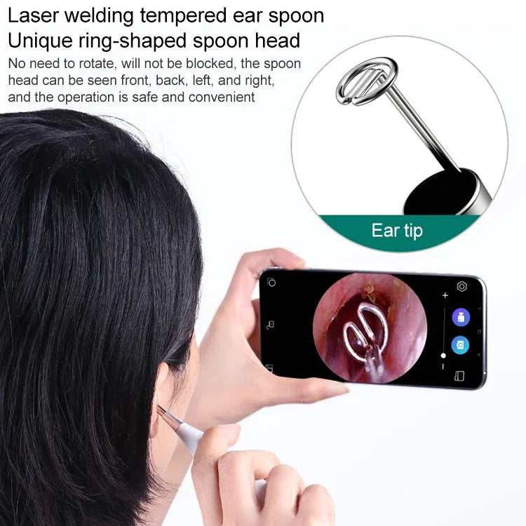 Nội soi tai Supereyes Y009 với kính lúp vi mô làm sạch mụn, Y009