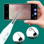 Nội soi tai Supereyes Y009 với kính lúp vi mô làm sạch mụn, Y009