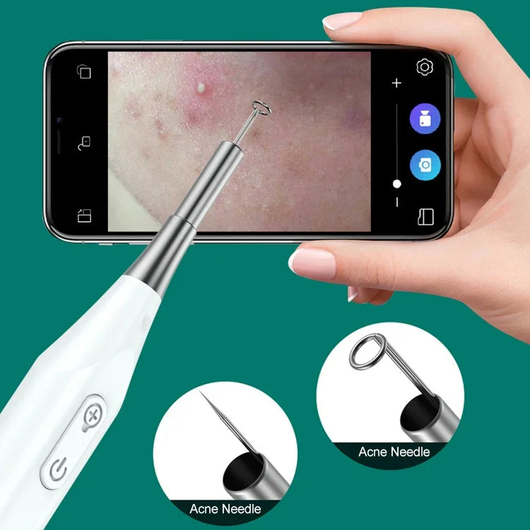 Nội soi tai Supereyes Y009 với kính lúp vi mô làm sạch mụn, Y009