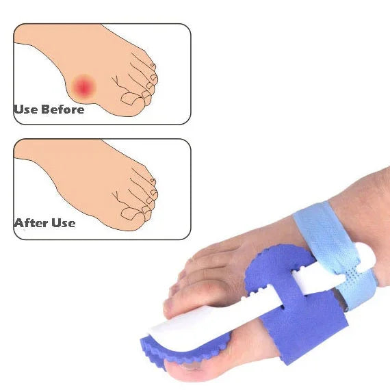1 đôi nẹp ban đêm ZRWC14 chỉnh thẳng, ZRWC14