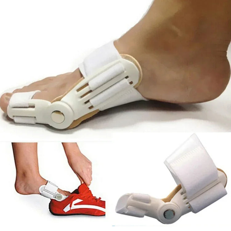 Nẹp chỉnh ngón chân cái lệch, dụng cụ chỉnh hình giảm đau bàn chân, hỗ trợ điều trị Hallux Valgus, màu trắng
