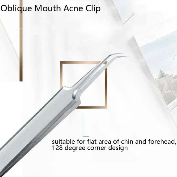Bộ 5 cái kim nặn mụn bằng thép không gỉ, kẹp mụn, dụng cụ nặn mụn đầu đen 5 trong 1
