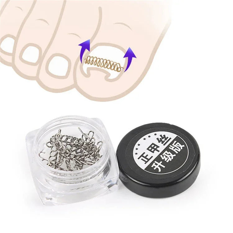Bộ 12 dụng cụ chỉnh móng chân cho móng mọc ngược