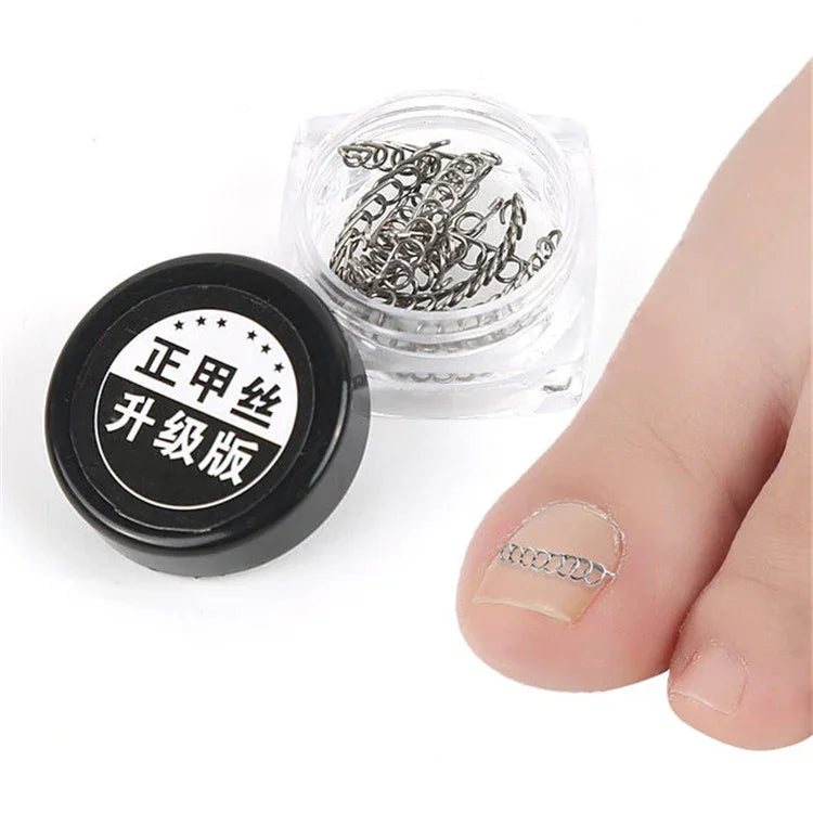 Bộ 12 dụng cụ chỉnh móng chân cho móng mọc ngược