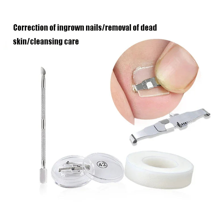 Dụng cụ chỉnh móng chân mọc ngược có khóa chỉnh hình, Khóa móng số 36, Khóa móng số 38, Khóa móng số 40, Khóa móng số 42, Khóa móng số 44, Bộ số 36, Bộ số 38, Bộ số 40, Bộ số 42