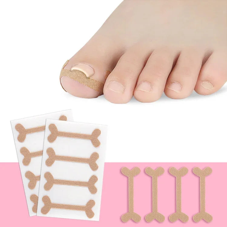 10 bộ băng dán chỉnh móng cuộn cho rãnh móng chân