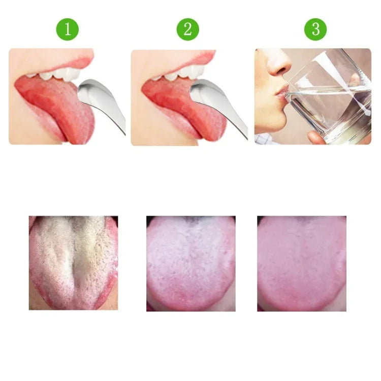 Dụng cụ cạo lưỡi bằng thép không gỉ làm sạch hơi thở hôi + bộ hai món (vàng hồng), dụng cụ cạo lưỡi + bộ hai món (bạc), dụng cụ cạo lưỡi + bộ hai món (vàng hồng)