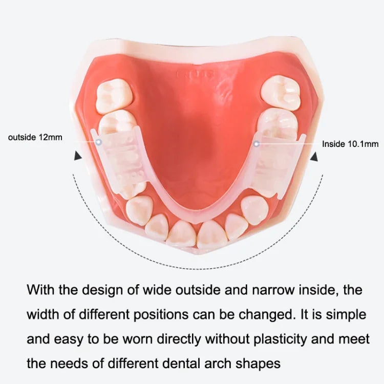 Dụng cụ chỉnh nha Y-Kelin mô phỏng silicone, Chống mắc cài molar ban đêm, Trong suốt