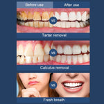 Máy cạo siêu âm điện cầm tay làm sạch răng tại nhà, thiết bị cạo vôi răng di động