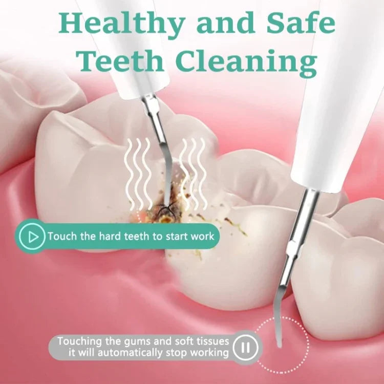 Máy cạo răng điện siêu âm làm sạch mảng bám và vôi răng có đèn LED, gói A, gói B, gói A kèm phụ kiện, gói B kèm phụ kiện