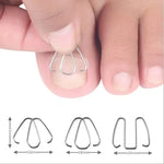 6 chiếc / hộp móng chỉnh hình dây kim loại cắm móng chân chỉnh hình móng